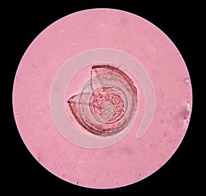 Parasite egg in stool exam.