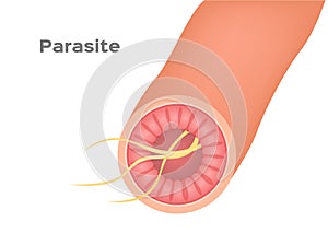 Parasite in stomach and intestine vector
