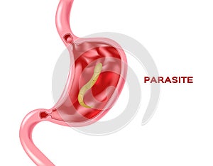 Parasite in stomach photo