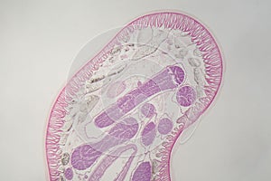 Parasitic nematode worm Ascaris sp. under the microscope