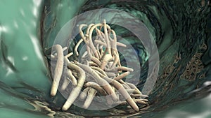 Parasitic worms in the lumen of intestine