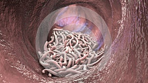 Parasitic worms in the lumen of intestine