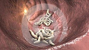 Parasitic worms in the lumen of intestine, 3D illustration