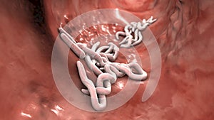 Parasitic worms in the lumen of intestine, 3D illustration