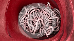 Parasitic worms in the lumen of intestine, animation