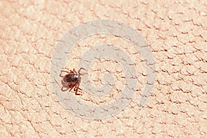 parasitiform tick Ixodidae, blood-sucking parasites on skin, Acariformes, carrier of dangerous disease encephalitis, illness