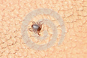 parasitiform tick from order Ixodidae, blood-sucking parasites on skin, Acariformes, carrier of dangerous disease encephalitis,