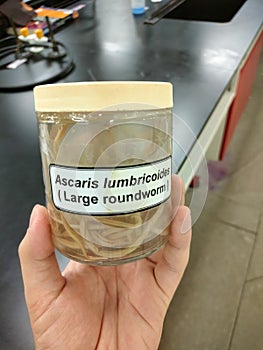 Parasitology, Ascaris lumbricoides,parasite, medical student photo