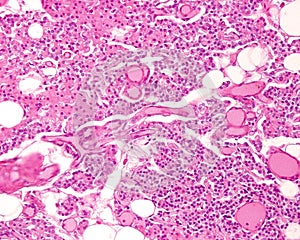 Parathyroid gland. Cell types photo