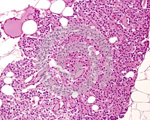 Parathyroid gland. Cell types photo