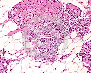 Parathyroid gland. Cell types photo