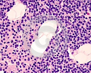 Parathyroid gland. Cell types photo