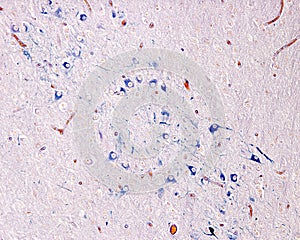 Paraventricular nucleus. Paraldehyde-thionine