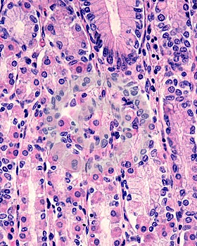 Parietal cells photo