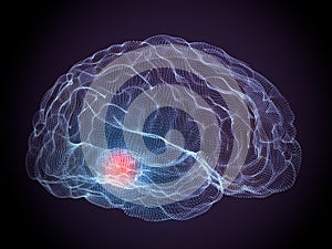 Parkinson degenerative brain diseases photo