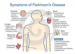 Parkinson`s disease symptoms and signs.