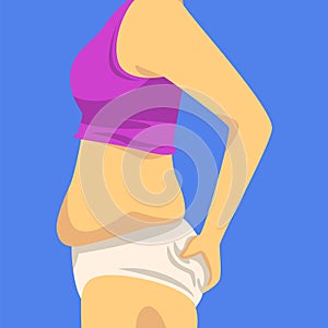 Part of Female Body with Fat Belly, Human Figure After Weight Loss, Side View, Obesity and Unhealthy Eating Problems