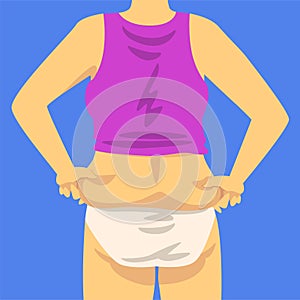 Part of Female Overweight Body, Human Figure After Weight Loss, Back View, Obesity and Unhealthy Eating Problems Vector