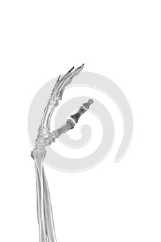 A part of the skeleton is the bones of a human hand, hand and forearm