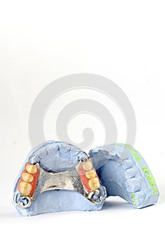 Partial denture 7