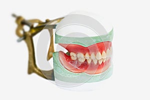 Partial denture production on white background