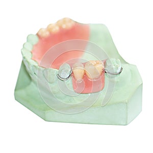 Partial denture production on white background