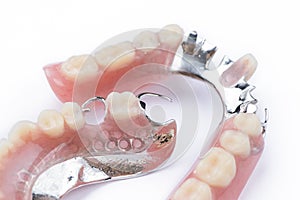 Partial denture upper side on a white background photo