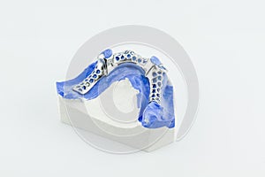Partial Denture on white background
