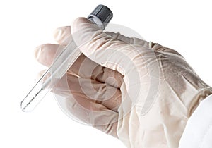 Paternity test - doctor holding buccal swab in test tube photo