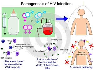 Pathogenesis of HIV infection