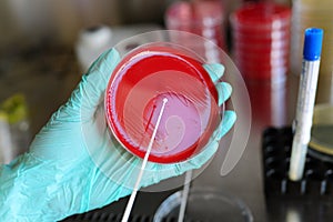 Pathological bacteria test