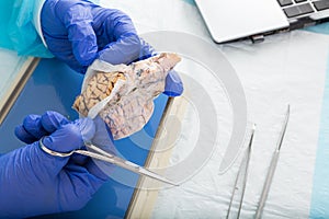 Pathologist opening a tissue sample in the lab