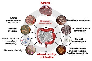 Pathophysiology of irritable bowel syndrome IBS