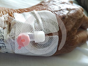 Patient with bandages under medications and hospitalizations laying on bed.