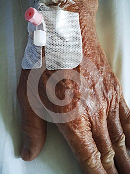 Patient with bandages under medications and hospitalizations laying on bed.