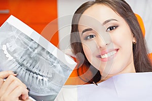 Patient beautiful girl holding x-ray picture of her teeth