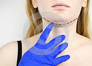 Mentoplasty: plastic chin. Patient before chin and neck surgery. Plastic surgeon advises photo