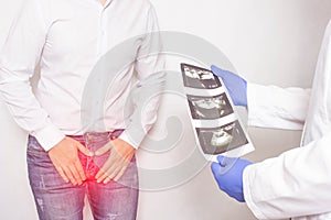 A patient with chronic prostatitis and problems with libido at the reception and consultation with a urologist doctor photo