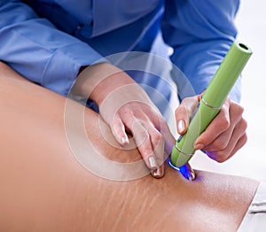 Patient in clinic undergoing laser scar removal