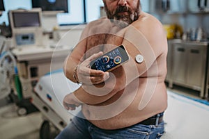 Patient connecting continuous glucose monitor with smartphone, to check blood sugar level in real time. Obese