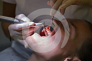 Patient at dental hygienists office