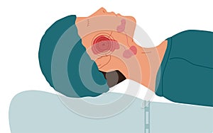 A patient with a diseased parotid salivary gland photo