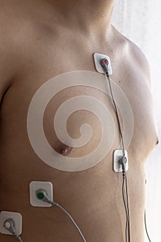 Patient with holter study