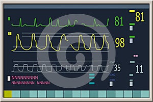 Patient monitor showing vital signs ECG and EKG. Vector illustration