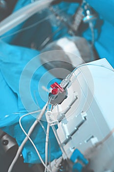 Patient on the operating table connected to the ventilator and a