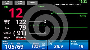 Patient returns from medical death, pulse down then up, ER vital signs monitor