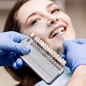Patient`s teeth shade with samples for bleaching treatment.