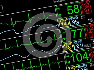 Patient`s vital signs on ICU monito photo