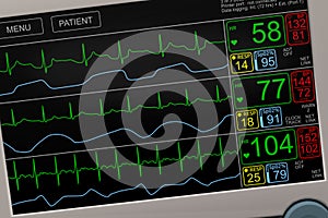 Patient`s vital signs on ICU monitor