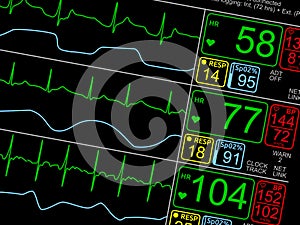 Patient`s vital signs on ICU monitor photo